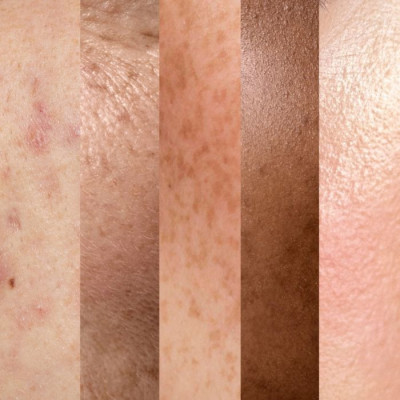 Bien choisir ses soins en fonction de son type de peau